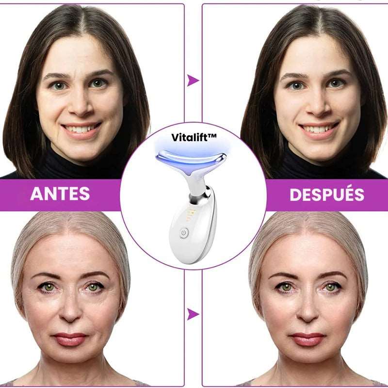 Masajeador Facial Anti Papada! 7 Modos de Luz LED🌟